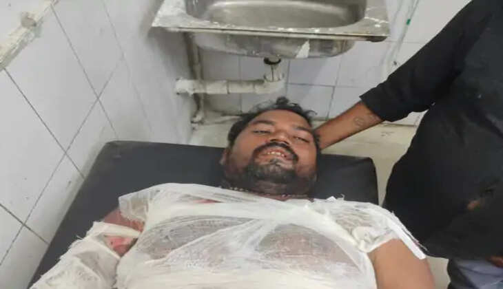 बिजली विभाग की बड़ी चूक! ट्रांसफॉर्मर की मरम्मत के दौरान करंट लगने से मिस्त्री झुलसा, अस्पताल में भर्ती